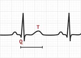 Understanding QT Prolongation and Medication Interactions: A Critical Concern